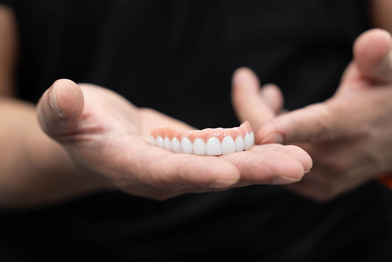 full arch model, denture model, dental implants