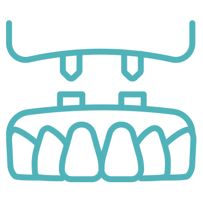 implant supported denture