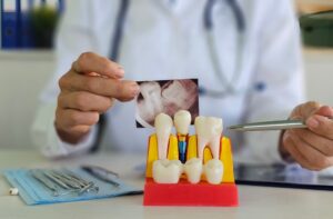 A smiling woman in the dental chair is consulting with a male dental implant dentist in Tampa, FL. No text on image.