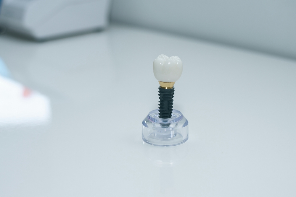 Dentist consulting patient about dental implant options